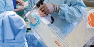 neuromate robot cleared for use by US FDA neuromate robot cleared for use by US FDA