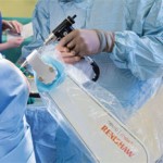 neuromate robot cleared for use by US FDA